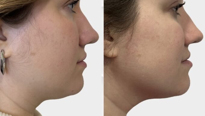 sickscience-labs-shapeshift-serum-neck-and-jawline.jpg