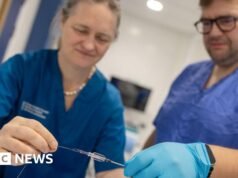 Cirujanos de Dundee y EE. UU. realizan la primera cirugía de accidente cerebrovascular del mundo utilizando un robot