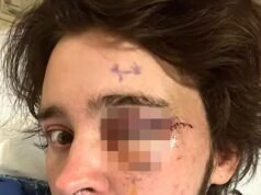 Manifestante anti-ICE quedó ciego de un ojo después de ser alcanzado por un proyectil durante una protesta contra ICE