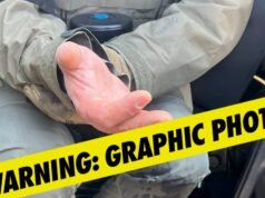 El subsecretario de Seguridad Nacional dice que los alborotadores mordieron el dedo de un agente en Minnesota