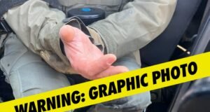 El subsecretario de Seguridad Nacional dice que los alborotadores mordieron el dedo de un agente en Minnesota