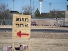 Al menos 171 casos de sarampión confirmados en 9 estados: CDC