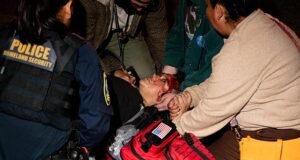 Caos cuando un manifestante ensangrentado es atropellado por un automóvil durante una protesta contra ICE en una calle de Los Ángeles