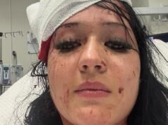 La hermana de una mujer de 20 años, presuntamente apuñalada por su colega rechazado en el club de la liga, detalla el horrible ataque y elogia al héroe que la salvó