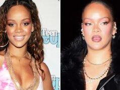 Rihanna ¿Buenos genes o buenos médicos?