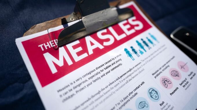 measles-form-gty-jt-260227_1772203209993_hpMain_16x9.jpg