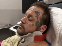 Jelly Roll revela hospitalización ‘secreta’ y fractura de clavícula